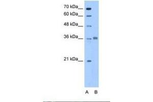 Image no. 1 for anti-Aldolase C, Fructose-Bisphosphate (ALDOC) (N-Term) antibody (ABIN6738437) (ALDOC 抗体  (N-Term))