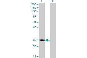 Western Blot analysis of RALB expression in transfected 293T cell line by RALB MaxPab polyclonal antibody. (RALB 抗体  (AA 1-206))
