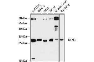Western blot analysis of extracts of various cell lines, using DENR antibody (ABIN6133498, ABIN6139534, ABIN6139535 and ABIN6217790) at 1:3000 dilution. (Density Regulated Protein 抗体  (AA 1-198))