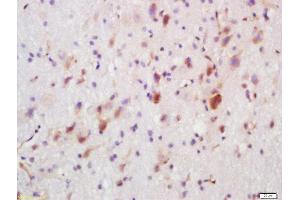 Formalin-fixed and paraffin embedded rat brain labeled with Rabbit Anti-FUT8 Polyclonal Antibody, Unconjugated  at 1:200 followed by conjugation to the secondary antibody and DAB staining (FUT8 抗体  (AA 311-410))