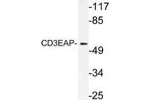 Western blot (WB) analysis of CD3EAP antibody in extracts from A549 cells. (CD3EAP 抗体)