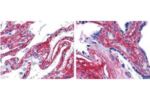 anti collagen V antibody (600-401-107 Lot 22063, 1:200, 45 min RT) showed strong staining in FFPE sections of human lung (left) with strong staining within alveoli, vessels, and in connective tissue spaces; and placenta (right) with strong staining observed in stromal and connective tissue spaces and vessel walls. (Collagen Type V 抗体  (HRP))