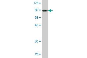 Western Blot detection against Immunogen (87. (CCT8L2 抗体  (AA 1-557))