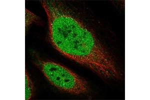 Immunofluorescent staining of human cell line U-2 OS with CTDSPL2 polyclonal antibody  at 1-4 ug/mL dilution shows positivity in nucleus but not nucleoli.