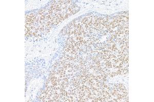 Immunohistochemistry (IHC) image for anti-Mediator Complex Subunit 1 (MED1) (AA 1550-1581) antibody (ABIN7455140)