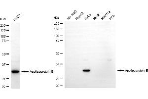 Western blotting analysis using apolipoprotein E antibody (ABIN7797629). (Recombinant APOE 抗体)