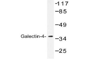 Western blot (WB) analysis of Galectin-4 antibody in extracts from COLO cells. (GAL4 抗体)
