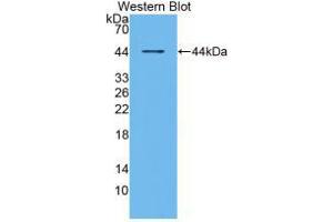 Western blot analysis of recombinant Human RANk. (TNFRSF11A 抗体  (AA 330-615))