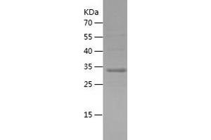 Western Blotting (WB) image for Synaptojanin 2 Binding Protein (SYNJ2BP) (AA 1-117) protein (His-IF2DI Tag) (ABIN7125267) (SYNJ2BP Protein (AA 1-117) (His-IF2DI Tag))