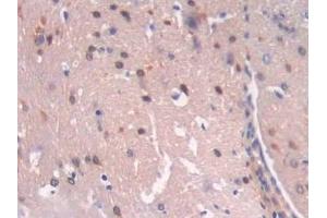 Immunohistochemistry (IHC) image for anti-Chromosome 6 Open Reading Frame 150 (C6orf150) (AA 211-395) antibody (ABIN7443491)
