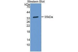 Western blot analysis of the recombinant protein. (PPOX 抗体  (AA 9-300))