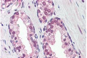 Human Prostate (formalin-fixed, paraffin-embedded) stained with REXO1 antibody ABIN364336 at 5 ug/ml followed by biotinylated anti-mouse IgG secondary antibody ABIN481714, alkaline phosphatase-streptavidin and chromogen. (REXO1 抗体  (AA 1060-1221))