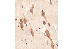 Antibody staining TGFBR2 in human brain sections by Immunohistochemistry (IHC-P - paraformaldehyde-fixed, paraffin-embedded sections). (TGFBR2 抗体  (N-Term))