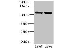 Western blot All lanes: EFCAB14 antibody at 4 μg/mL Lane 1: Colo320 whole cell lysate Lane 2: Hela whole cell lysate Secondary Goat polyclonal to rabbit IgG at 1/10000 dilution Predicted band size: 56 kDa Observed band size: 56 kDa (KIAA0494 抗体  (AA 1-483))