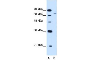 CBS antibody used at 1. (CBS 抗体  (N-Term))
