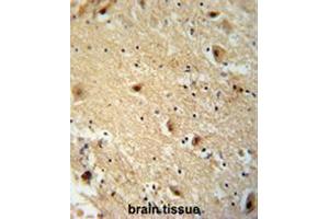 Immunohistochemistry (Paraffin-embedded Sections) (IHC (p)) image for anti-TBC1 Domain Family, Member 14 (TBC1D14) (AA 259-286), (Middle Region) antibody (ABIN955090)