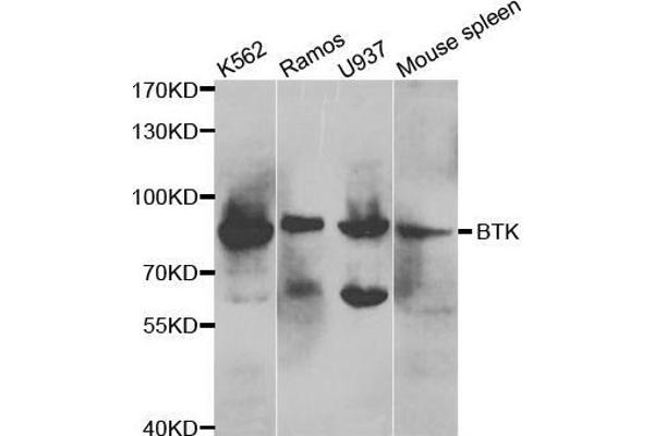 BTK 抗体  (AA 30-240)