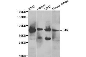 Western blot analysis of extracts of various cell lines, using BTK antibody.