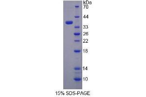 SDS-PAGE (SDS) image for Thiosulfate Sulfurtransferase (Rhodanese) (TST) (AA 2-297) protein (His tag) (ABIN4989555) (TST Protein (AA 2-297) (His tag))