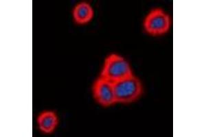 Immunofluorescent analysis of Cadherin 20 staining in HeLa cells. (Cadherin 20 抗体)