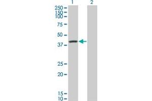 Western Blot analysis of SERPINA6 expression in transfected 293T cell line by SERPINA6 monoclonal antibody (M01), clone 1F11. (SERPINA6 抗体  (AA 23-405))