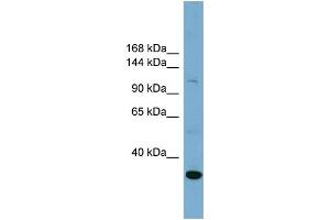 WB Suggested Anti-SLC9A1  Antibody Titration: 0. (SLC9A1 抗体  (Middle Region))
