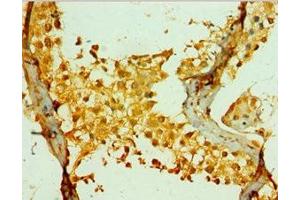 Immunohistochemistry of paraffin-embedded human testis tissue using ABIN7142036 at dilution of 1:100 (PIKFYVE 抗体  (AA 1819-2098))