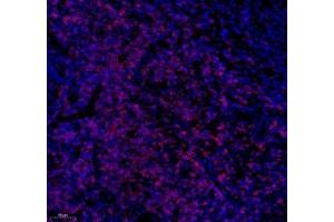 Immunofluorescence of paraffin embedded human tonsil using CD3 (ABIN7073386) at dilution of 1: 500 (200x lens) (CD3 抗体)