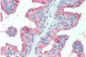 Anti-SLC39A14 antibody  ABIN1049336 IHC staining of human prostate. (SLC39A14 抗体  (Internal Region))