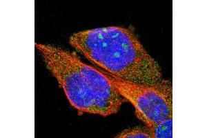 Immunofluorescent staining of human cell line A-431 shows positivity in nucleoli & cytoplasm. (PPM1B 抗体  (AA 359-463))