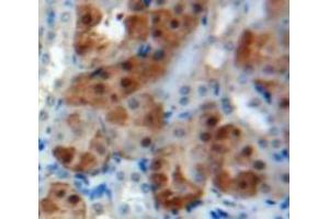 Used in DAB staining on fromalin fixed paraffin-embedded Kidney tissue (PSMC2 抗体  (AA 1-433))