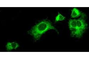 Image no. 2 for anti-Lysyl Oxidase (LOX) (AA 22-168) antibody (ABIN1491219) (LOX 抗体  (AA 22-168))