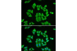 Immunofluorescence analysis of A549 cells using GSTM2 antibody.