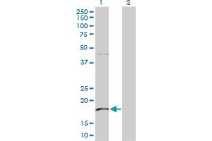 Western Blot analysis of KLRG1 expression in transfected 293T cell line by KLRG1 MaxPab polyclonal antibody. (KLRG1 抗体  (AA 1-189))