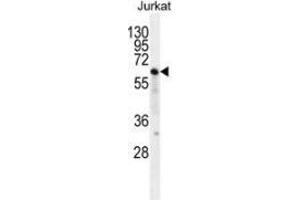 Western blot analysis in Jurkat cell line lysates (35ug/lane) using NKD2  Antibody (C-term). (NKD2 抗体  (C-Term))