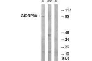 Western blot analysis of extracts from Jurkat/COS cells, using GIDRP88 Antibody. (GIDRP88 抗体  (AA 721-770))