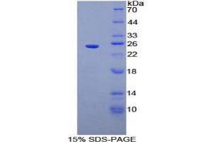 SDS-PAGE analysis of Rat Sprouty Homolog 3 Protein. (SPRY3 蛋白)