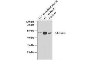 Western blot analysis of extracts of various cell lines using ST3GAL3 Polyclonal Antibody at dilution of 1:1000. (ST3GAL3 抗体)