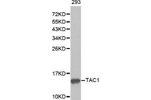 Western blot analysis of extracts of 293 cell lines, using TAC1 antibody. (TAC1 抗体  (AA 1-129))