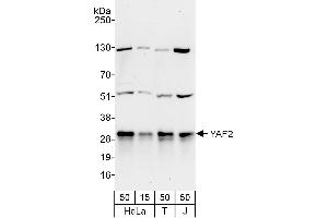 anti-YY1 Associated Factor 2 (YAF2) (AA 50-100) antibody