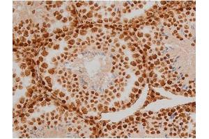 ABIN6267384 at 1/200 staining Mouse testis tissue sections by IHC-P. (Ezrin 抗体  (pTyr353))