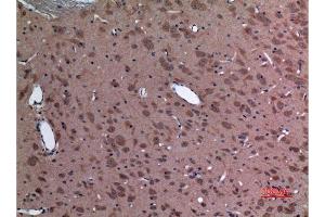 Immunohistochemistry (IHC) analysis of paraffin-embedded Rat Brain, antibody was diluted at 1:100. (UBE2A/B (C-Term) 抗体)