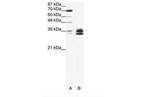 Image no. 1 for anti-Nuclear Factor-kB p65 (NFkBP65) (AA 21-70) antibody (ABIN203274) (NF-kB p65 抗体  (AA 21-70))