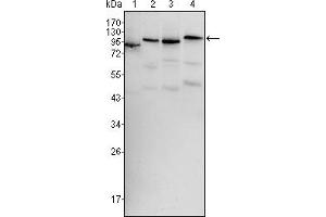 Western blot analysis using BRAF mouse mAb against Hela (1), HL60 (2), HepG2 (3) and NIH/3T3 (4) cell lysate. (BRAF 抗体)