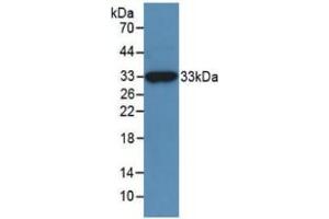 WB of Protein Standard: different control antibodies against Highly purified E. (MGEA5 ELISA 试剂盒)