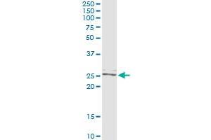 Immunoprecipitation of TWIST2 transfected lysate using anti-TWIST2 monoclonal antibody and Protein A Magnetic Bead , and immunoblotted with TWIST2 MaxPab rabbit polyclonal antibody. (TWIST2 抗体  (AA 1-160))