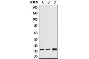 Western blot analysis of TRA2A expression in HeLa (A), Jurkat (B), 129Sv (C) whole cell lysates. (TRA2A 抗体  (C-Term))