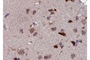 ABIN6267391 at 1/100 staining human brain tissue sections by IHC-P. (ATF2 抗体  (pThr55, pThr73))