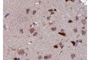 ABIN6267391 at 1/100 staining human brain tissue sections by IHC-P.