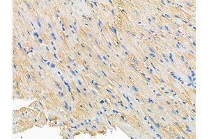 ABIN6260772 and ABIN6266926 at 1/100 staining Mouse heart tissue by IHC-P.
